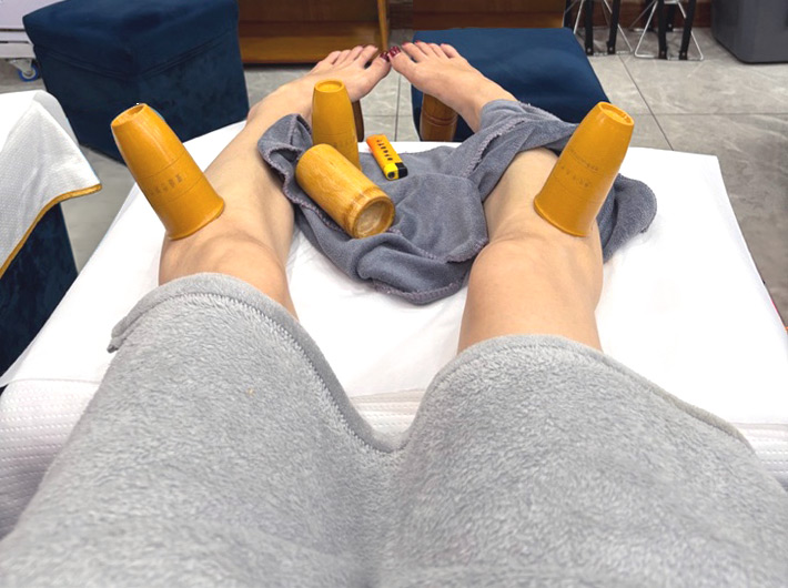 マッサージ後の抜罐（血行促進・疲労解消効果）